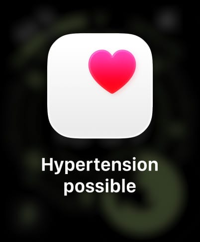 Apple Watch Ultra 3, titanium case, natural color, possible hypertension notification, pink heart in white box, band, Trail Loop, blue/bright blue color